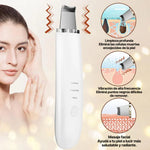 ✨💎 Lumiskin™ — Limpiador Ultrasónico 🧼⚡