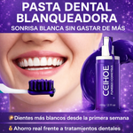 Blanqueador Dental™ – ¡Dientes más blancos al instante!