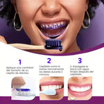 Blanqueador Dental V34™ – ¡Dientes más blancos al instante!